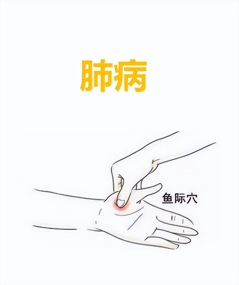 人体经络穴位高清图解大全，收好了，按摩艾灸、拔罐刮痧都用得到