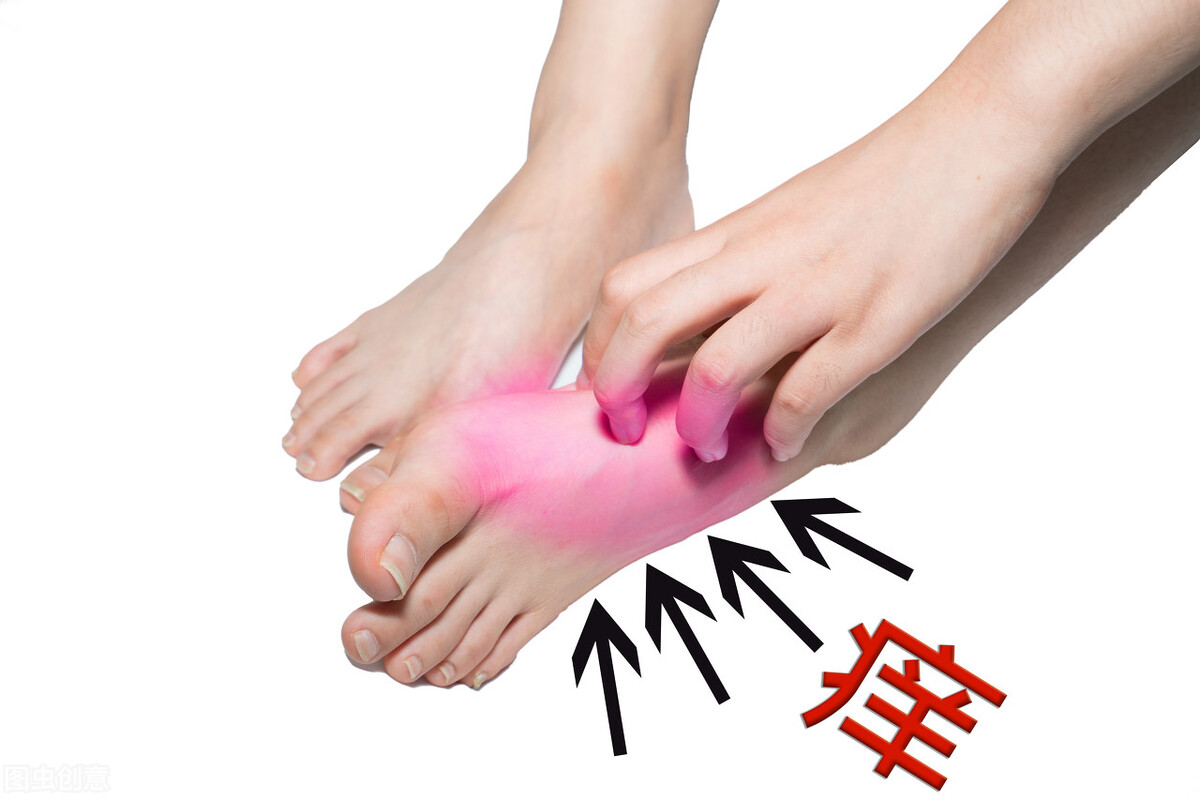 角化型足癣中药泡脚多长时间,角化型足癣可以用高锰酸钾泡脚