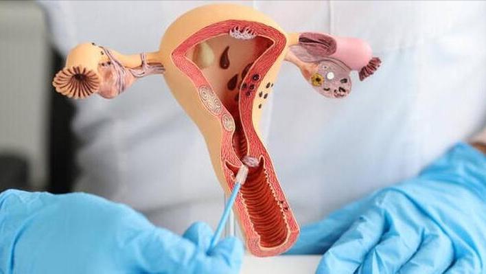 女性漏尿2年多治疗偏方,女性漏尿吃什么西药治愈