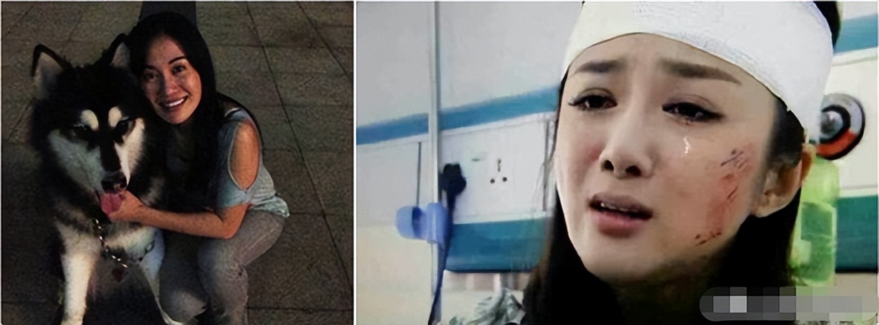 李依晓被狗咬为什么还会败诉,李依晓被狗咬前后的照片对比