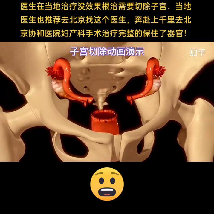 四川转院北京,四川患者转院北京