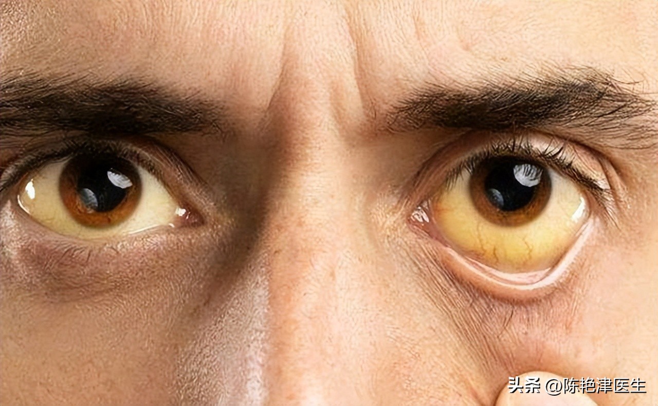 肝不好头部先知,肝变硬头部会有什么反应