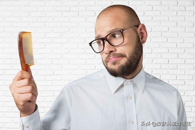 脱发头发出油原因有三种,头皮干了会脱发还是油了会脱发