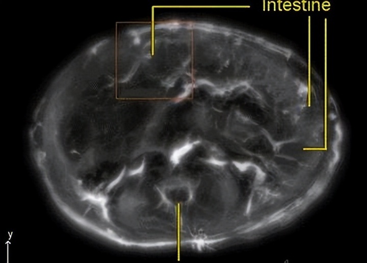 探索声波能否传递能量的实验,新型纳米材料在医学上的应用