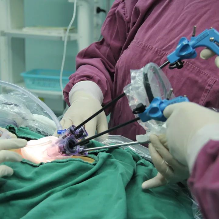 “术过无痕”，一个小孔解决孩子大问题