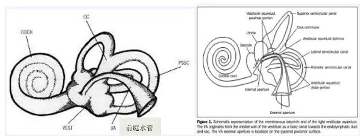 大前庭导水管正常值,大前庭导水管结构