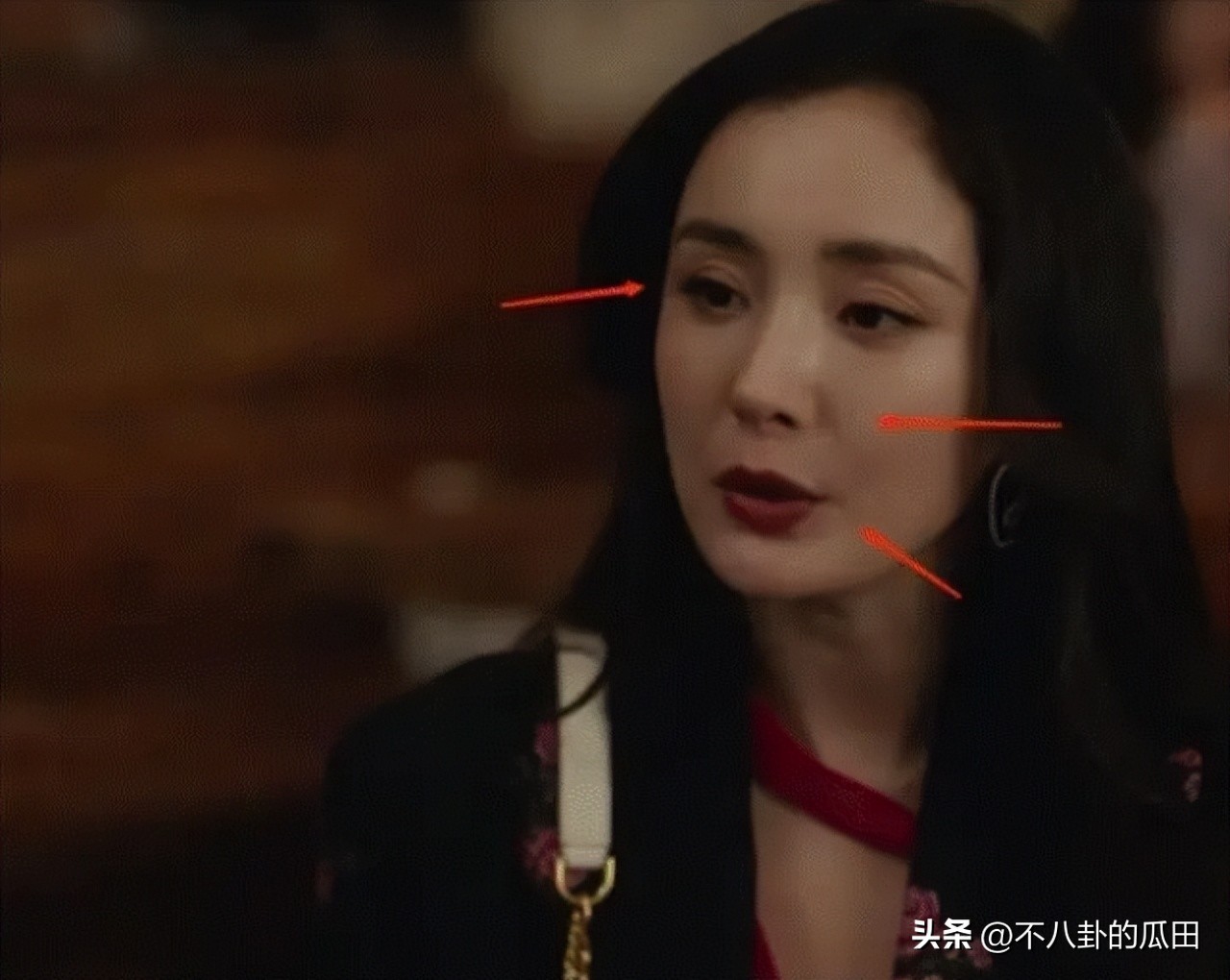 瘦到脱相的几位明星,12位瘦脱相的明星憔悴苍老