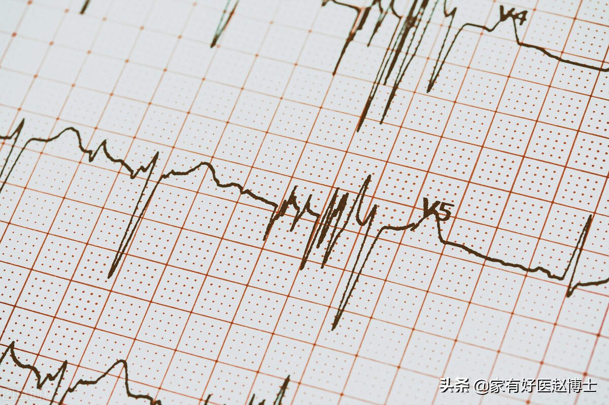 心脏早搏怎么治疗和预防,心脏早搏怎么知道轻微还是严重