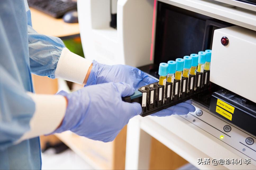 医生血脂化验单,医生一步一步教您看血脂化验单