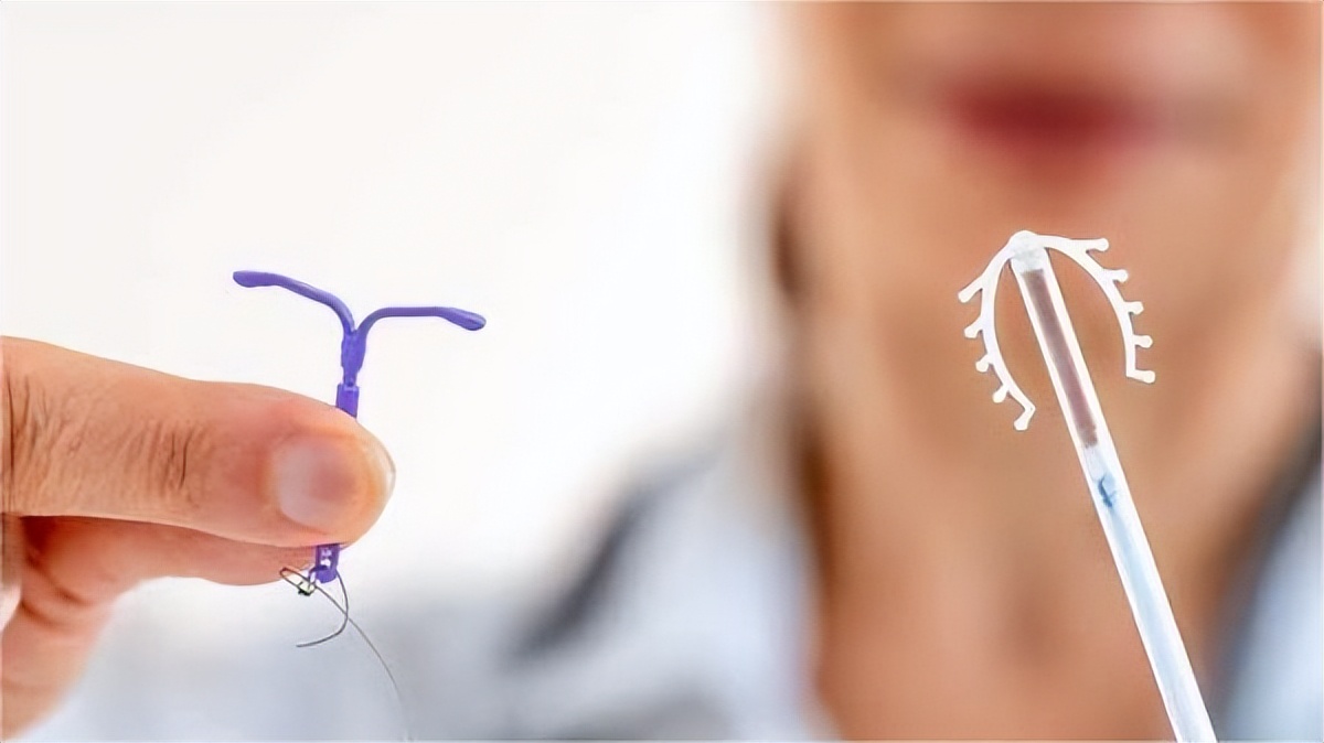 节育环在女性体内会发生哪些变化,女性节育环多少年必须取出来