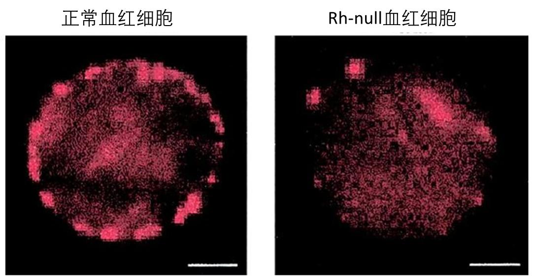 稀有血型熊猫血中的熊,什么血型比熊猫血稀有