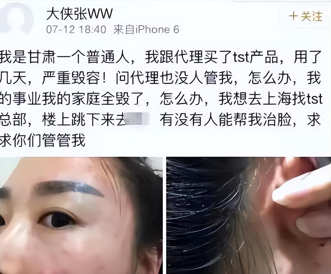 张庭夫妇公司原代理揭秘,张庭夫妇是代理商举报的吗