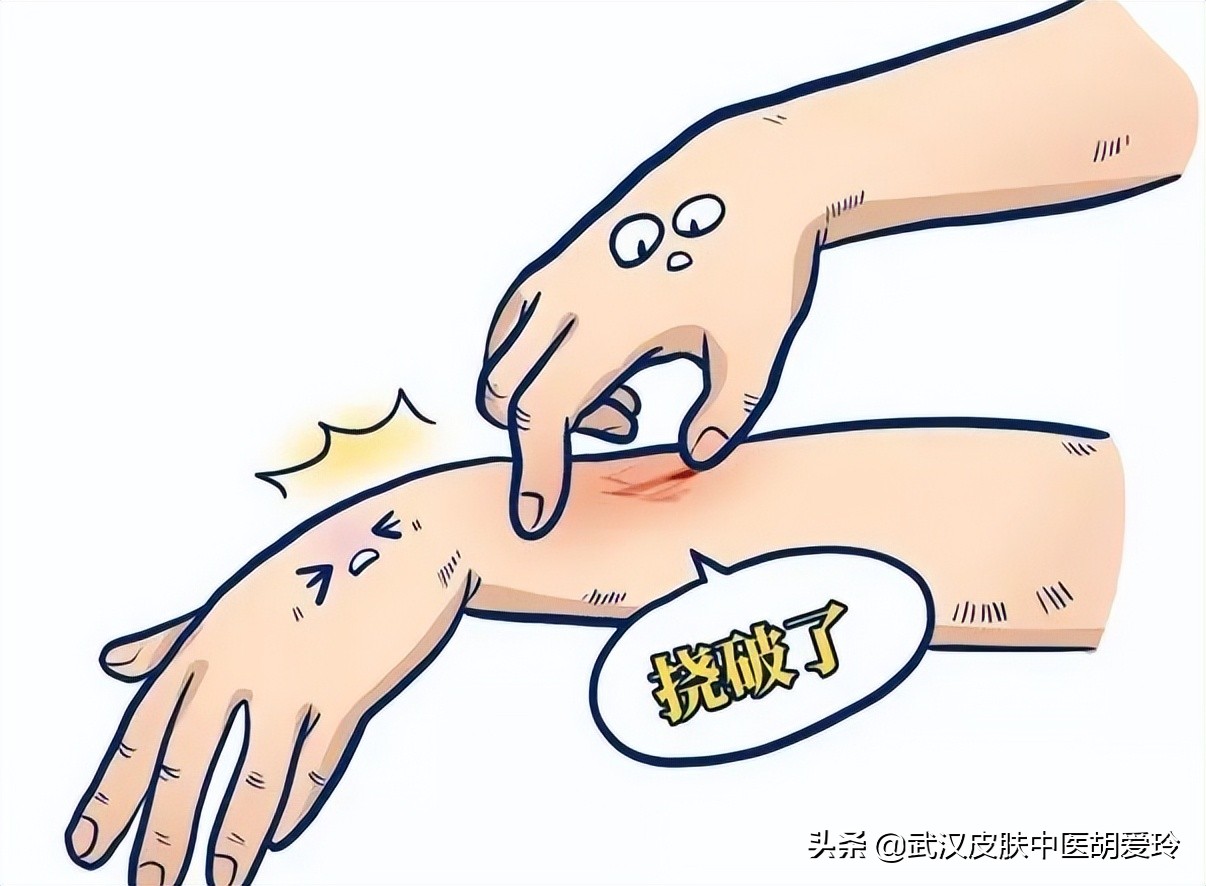 老人家身上痒是怎么回事治疗方法