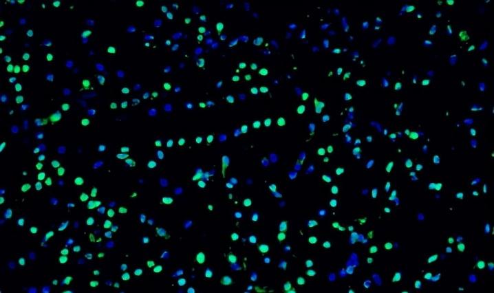 Mg2+掺杂，它对上转换发光材料Na2Zn3Si2O8:Er3+发光性能有何影响