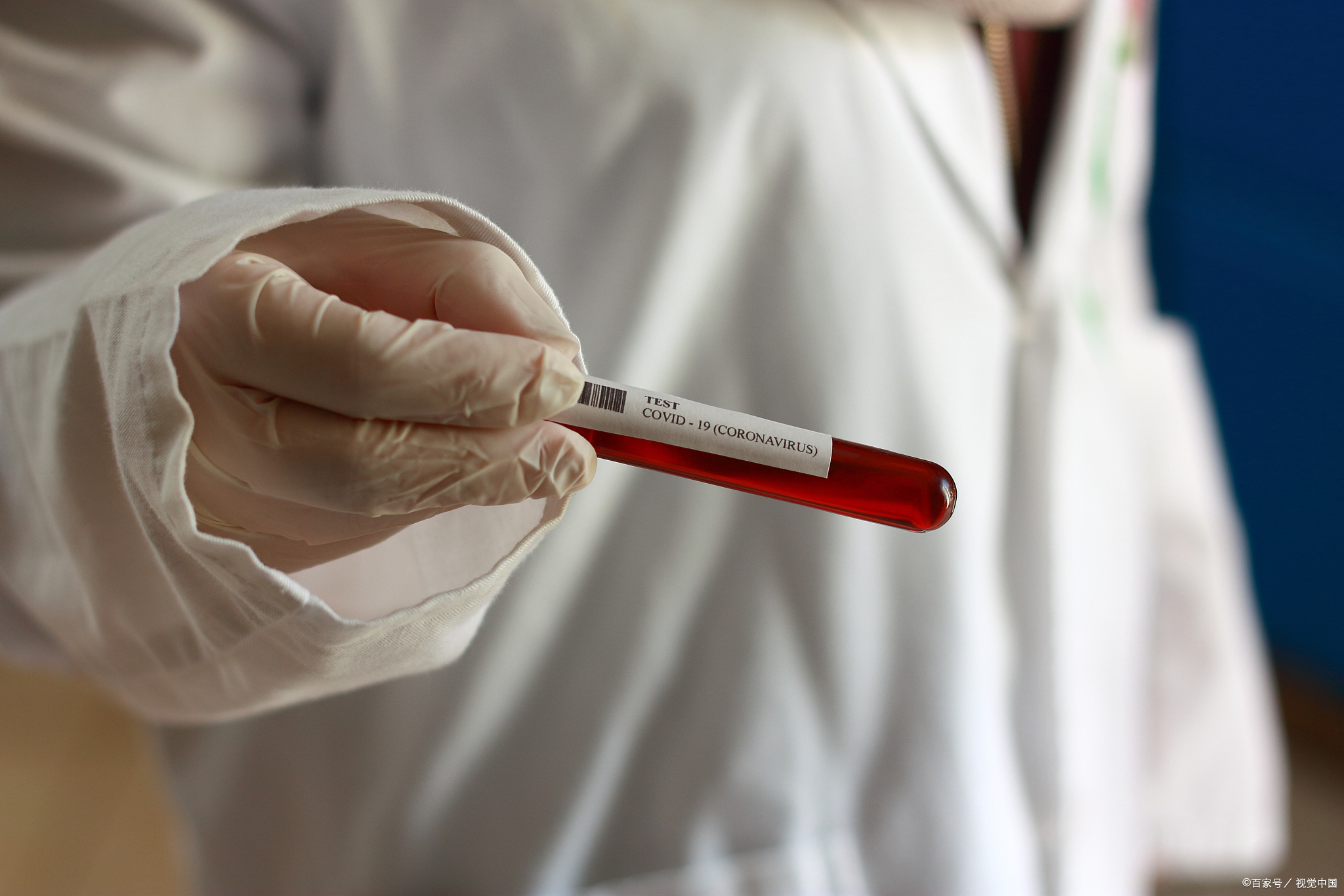 中医治乙肝的机理,中医治乙肝应从什么开始治