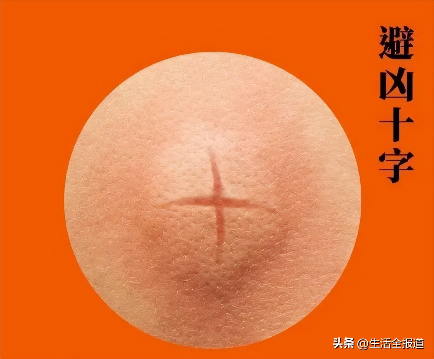 有什么老方法可以快速止痒蚊子包,怎么给蚊子包止痒