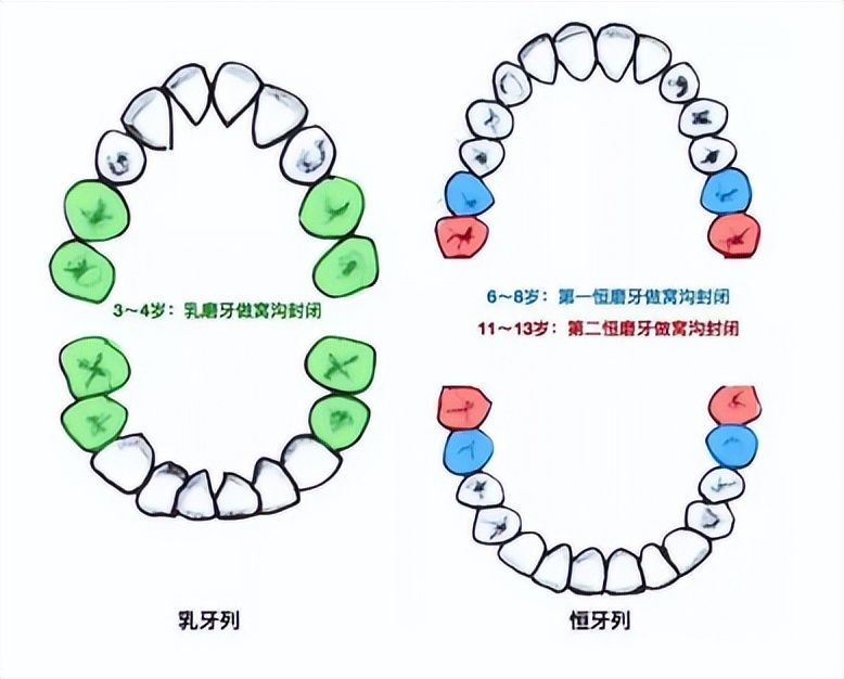 2022飞利浦儿童电动牙刷哪个好用,飞利浦usmile电动牙刷测评