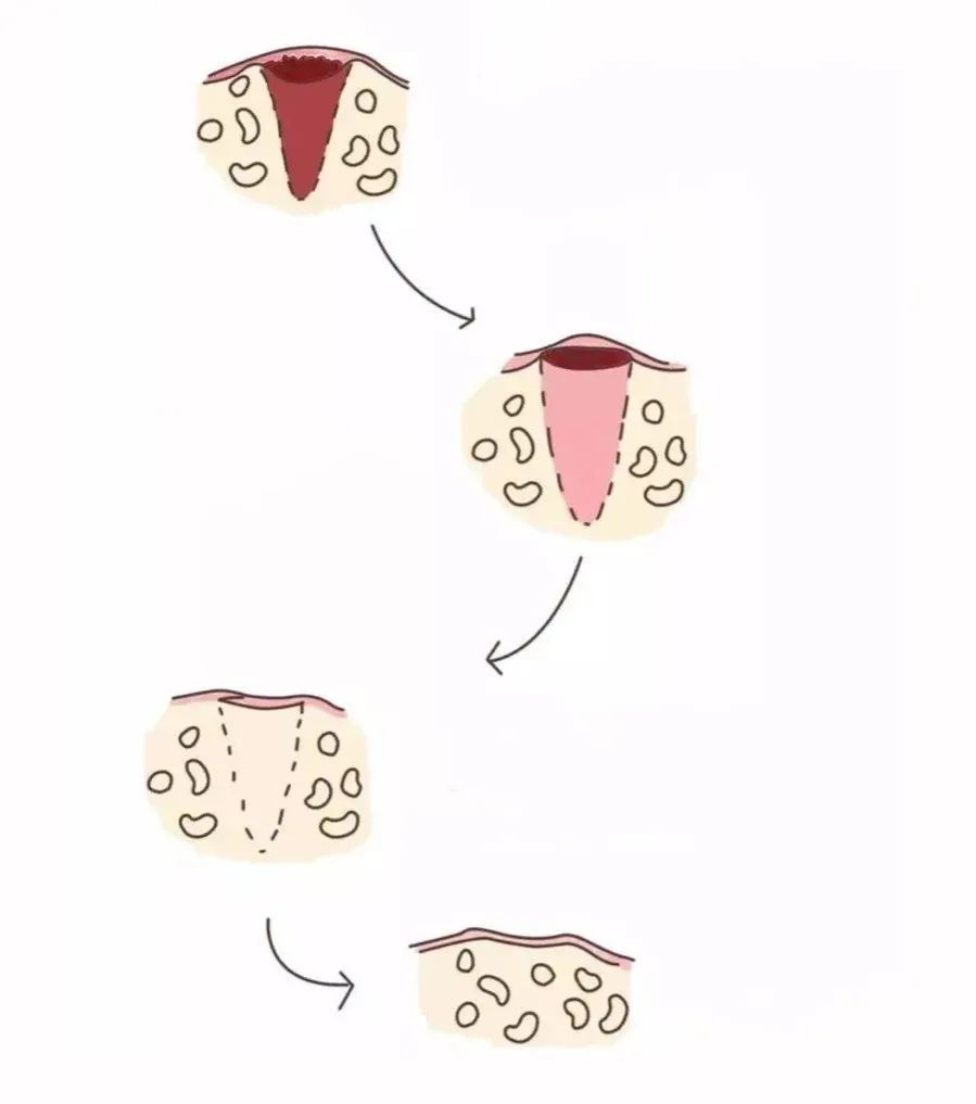 种植牙拔了做矫正,种植牙齿全过程真相大揭秘
