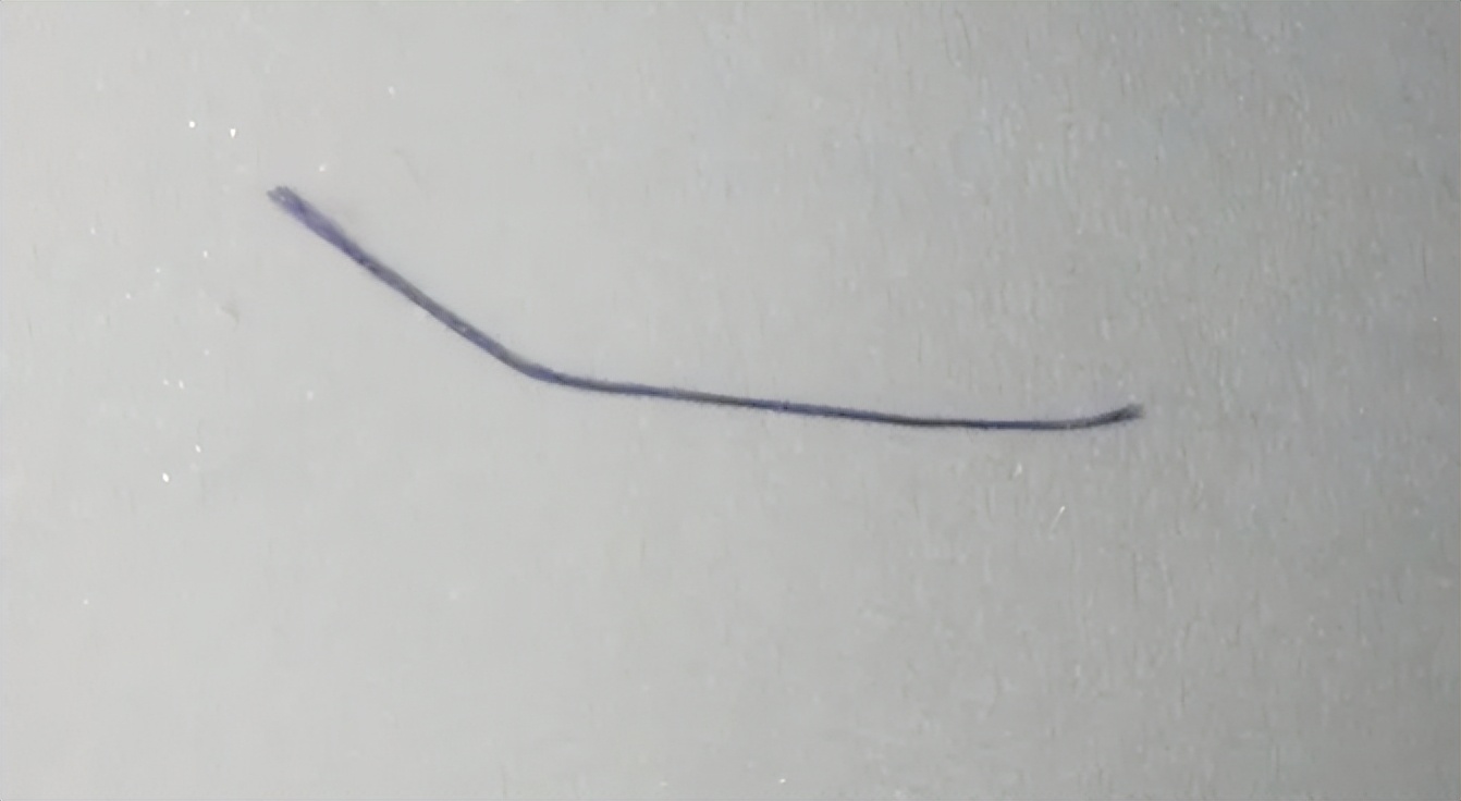 做痔疮手术换药全部流程,痔疮手术的真实经历第14天