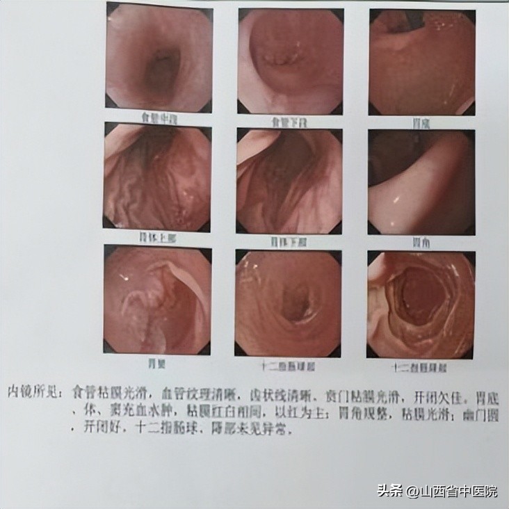 食管轻度不典型增生怎么治疗,中医可以治疗食管鳞状增生吗