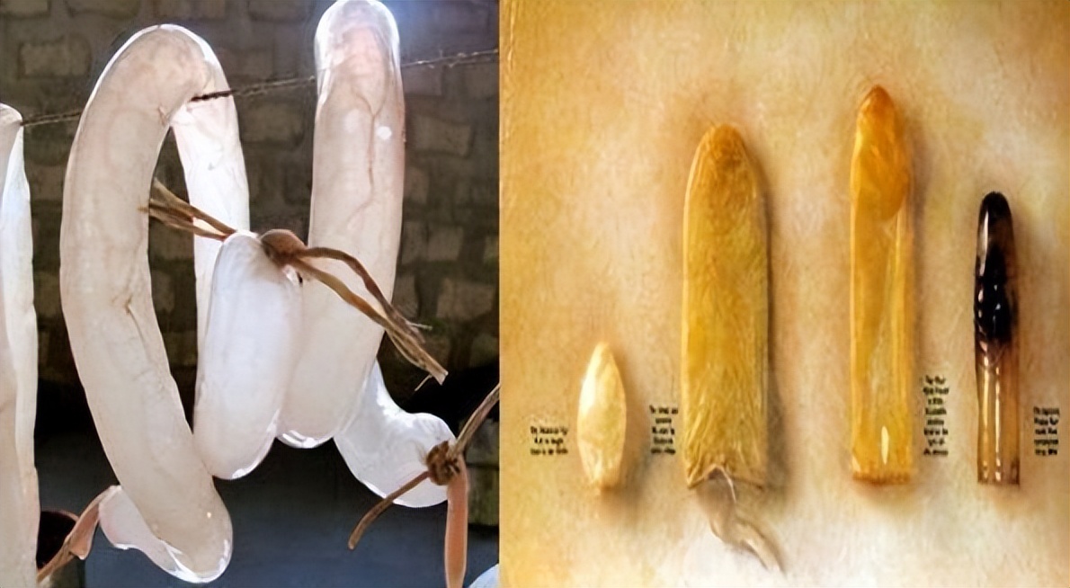 为什么安全套会过敏,为啥安全套要导热