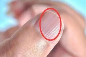 口苦眼睛干涩是胃肝有火吗,肝不好眼干口苦吃什么药