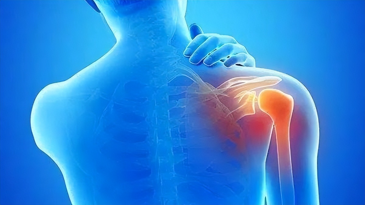 肩膀痛是颈椎病引起的吗怎样判断,肩膀痛或是致命信息