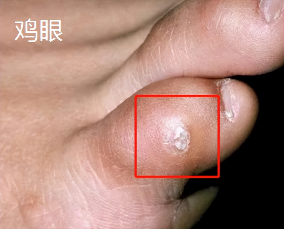 看图猜哪个是真哪个是假,看图猜猜哪个是真的哪个是假