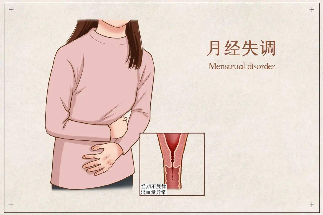 子宫内膜增厚是癌症的征兆吗,子宫内膜增厚是子宫癌症的前兆吗