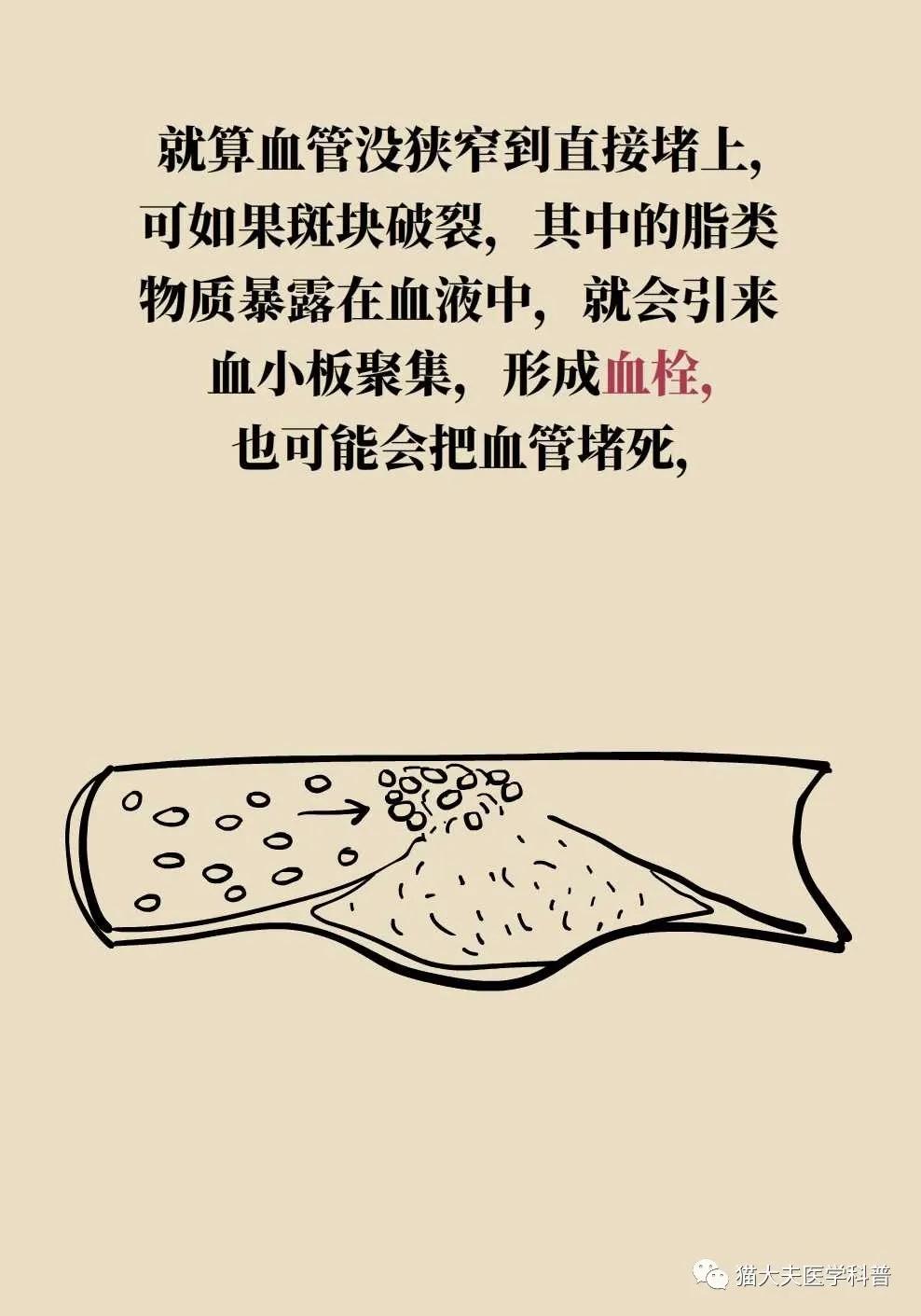 血管健康日为什么定在5月18日,血管的健康日