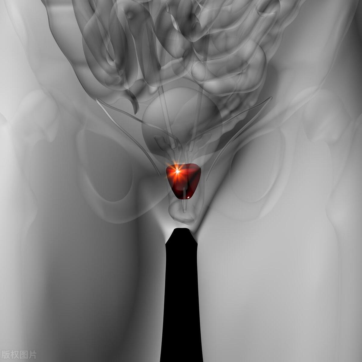 男生被踢到后会发生什么事,男生被踢到要紧吗