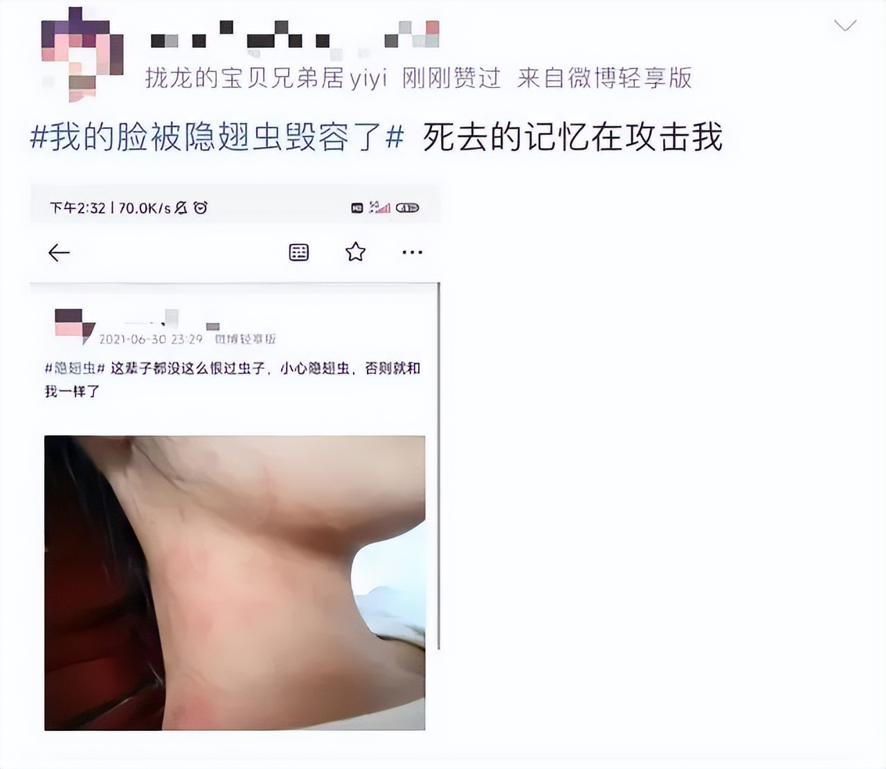 “我的脸被它毁容了…”毒液堪比硫酸！西安也有！