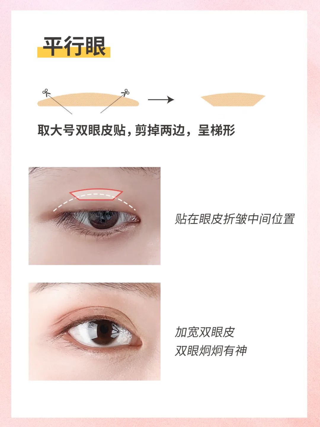 不同眼型的双眼皮贴贴法,各种眼型的双眼皮贴法详细教程