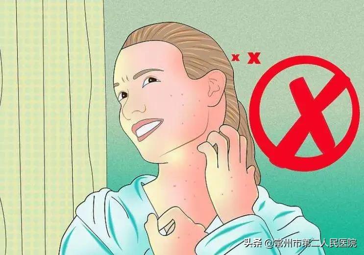 儿童手脚发热发痒是怎么回事,酒后手脚发红发痒是怎么回事