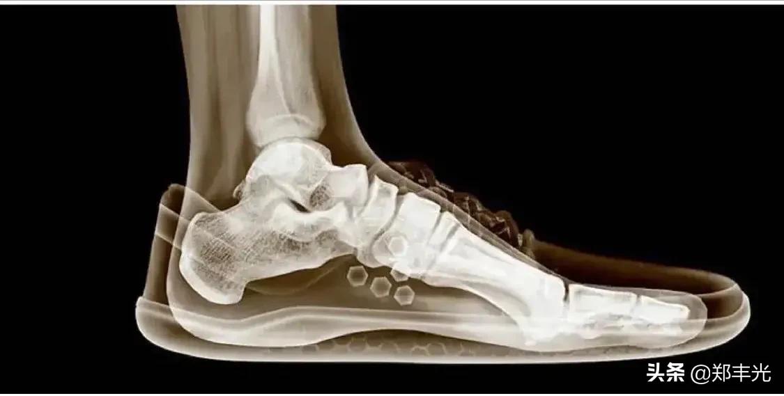 鞋子是选正好的码数还是偏大一码,鞋子码数适合但总穿不上