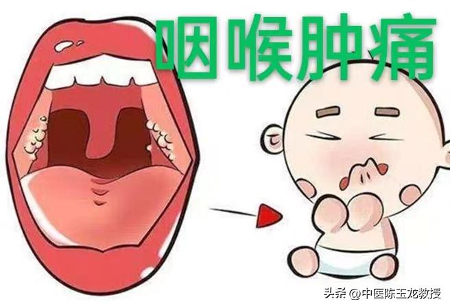 滤泡性咽喉炎中药方子,咽喉炎扁桃体炎常用中药