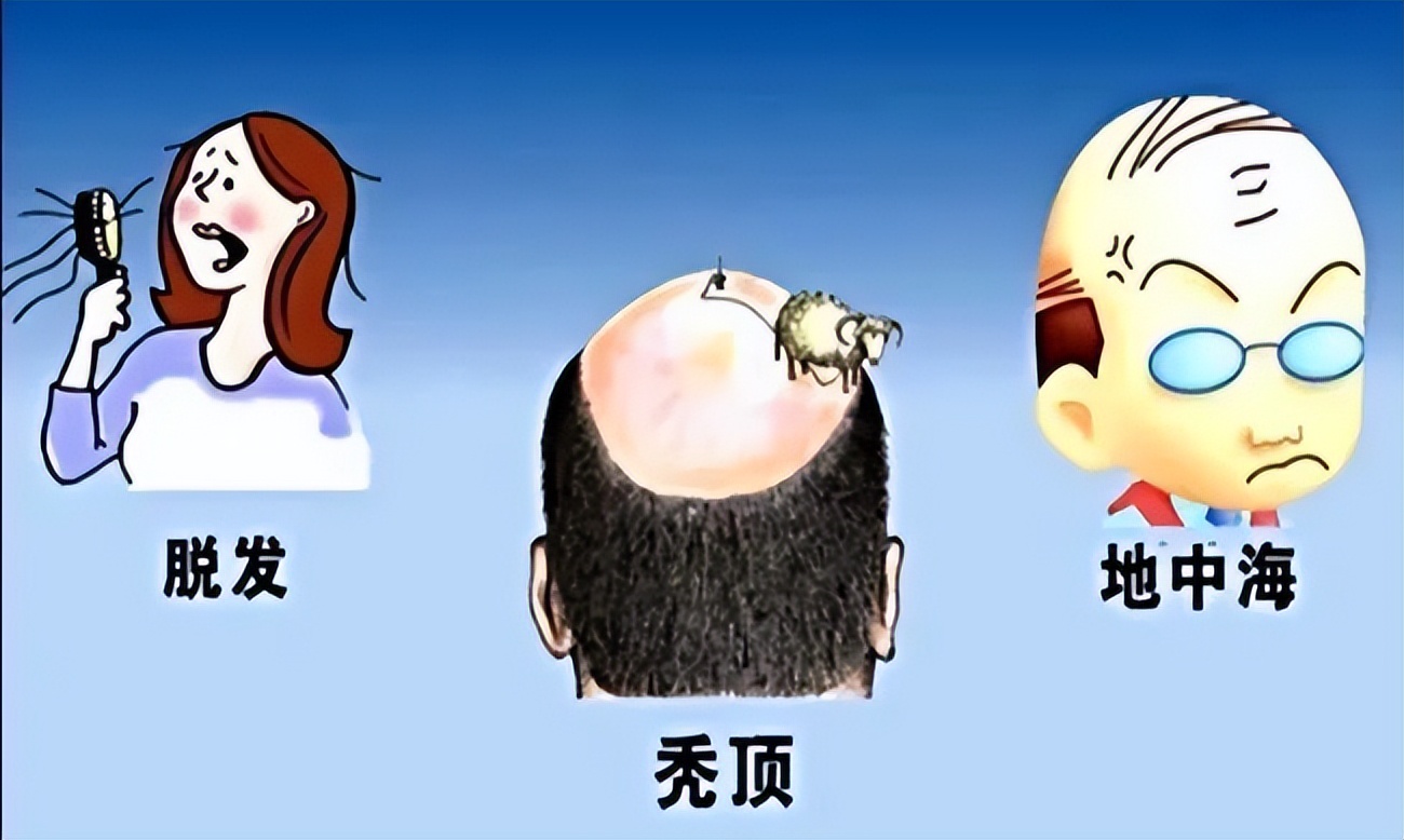 秃星人必看！大麦植发告诉你，不同部位脱发应如何对症治疗？