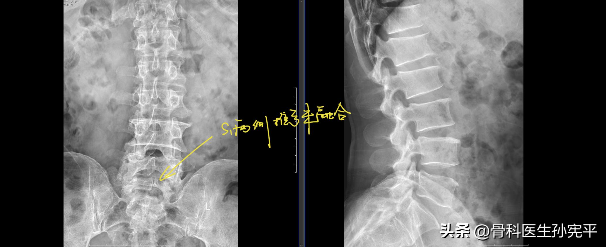 医学影像趣图,震撼的医学影像