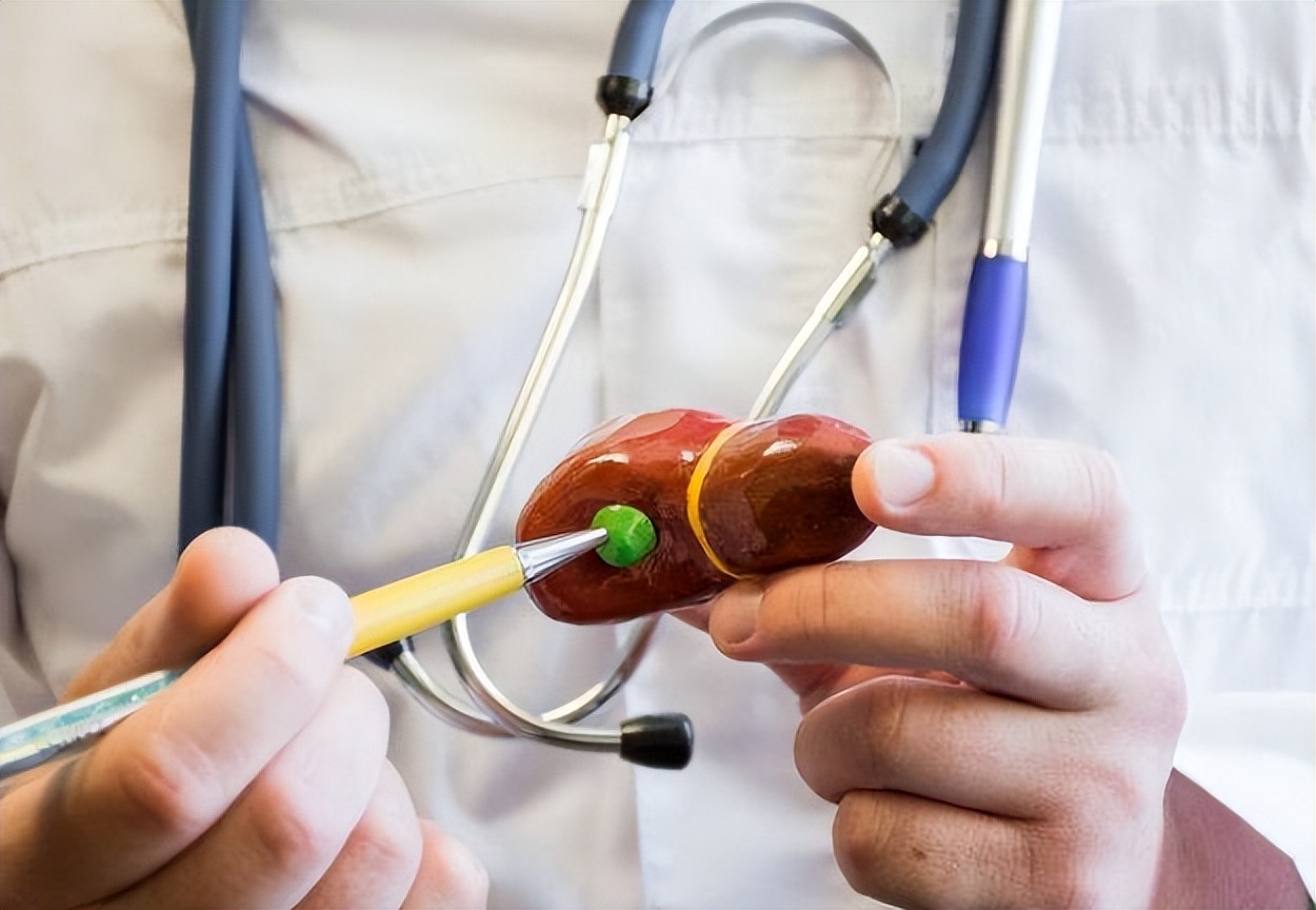 胆囊息肉切除后遗症怎样才能恢复,手术切除胆后有什么影响