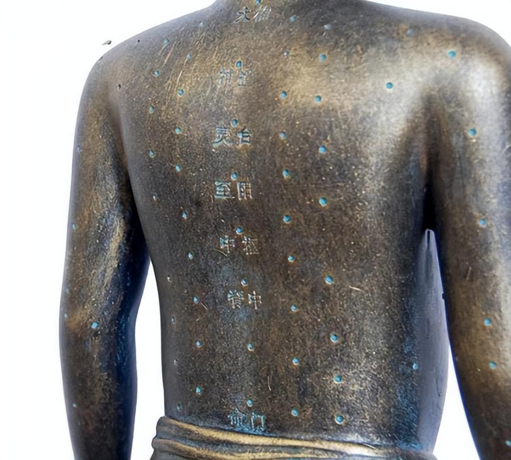 日本针灸铜人,日本古代铜人针灸