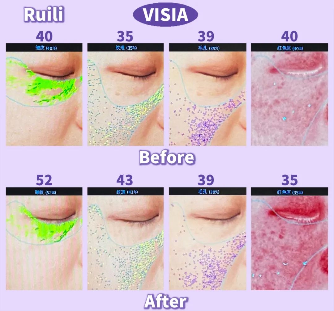 美肌抗老,城野医生169抗老精华测评