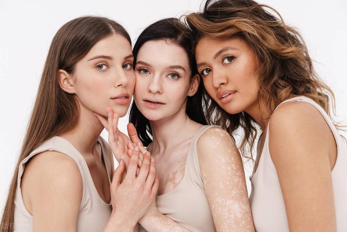 要想治好一定要选对方法,想要治好白癜风该注意什么呢