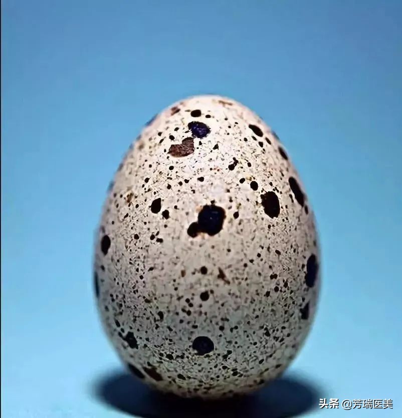 雀斑是怎么晒出来的,雀斑是怎么形成的过程