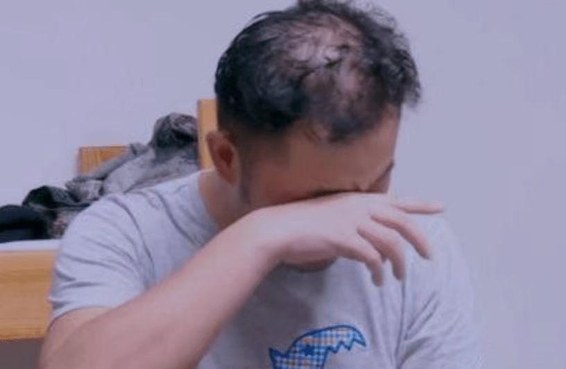 有哪些明星头发秃顶,秃顶明星发际线