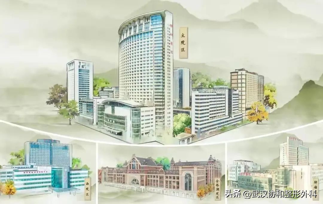 平行双眼皮手术图片,埋线双眼皮手术价格