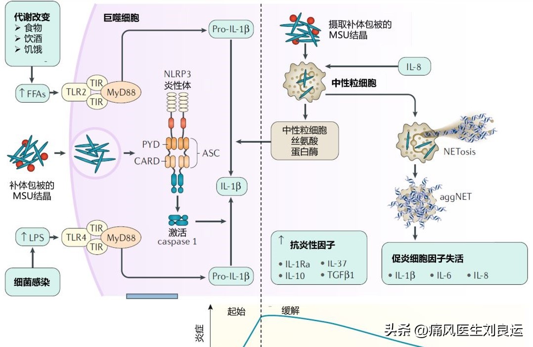 痛风怎么止痛除了吃药还有这6招,痛风的治疗方法低剂量服药