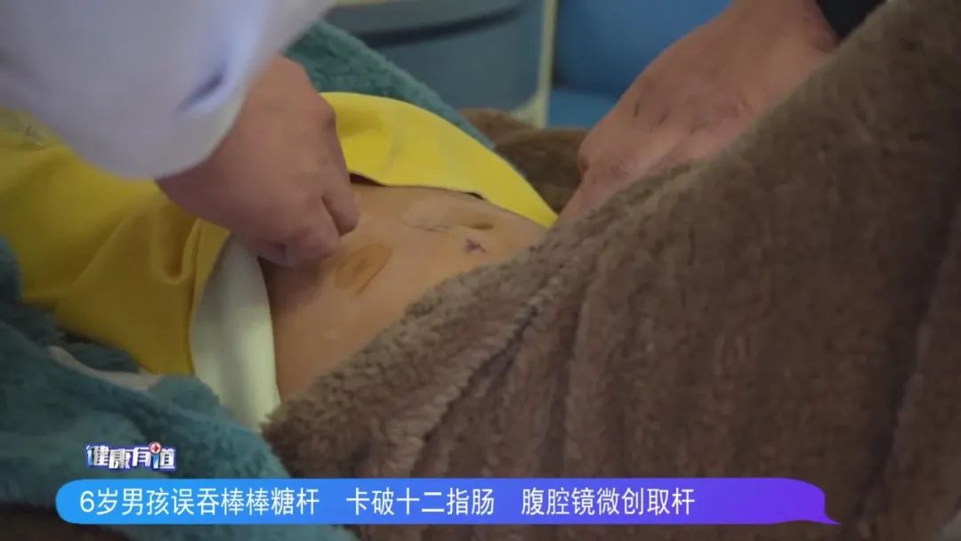 宝宝误吞棒棒糖棍后能自己排出吗,孩子把棒棒糖杆吞肚子里了该咋办