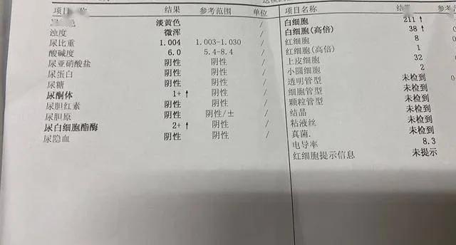 15秒看懂尿常规检查,一秒教你看孕检报告