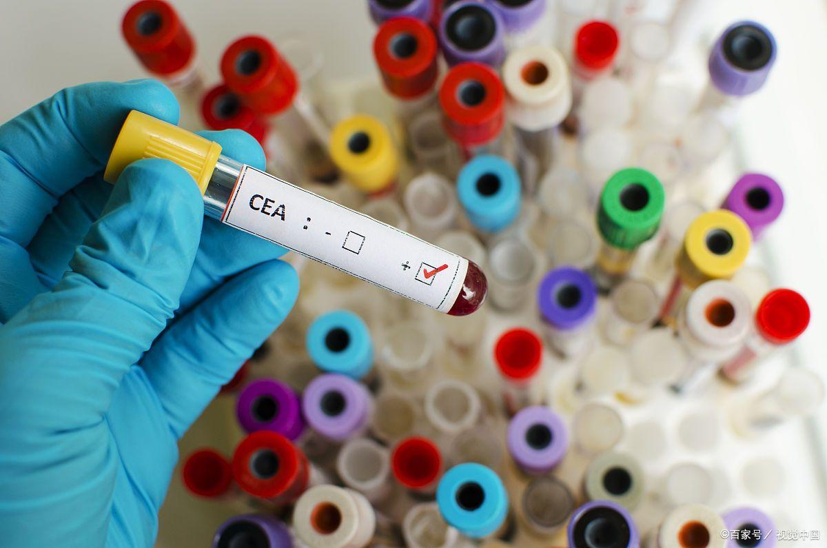 复查肿瘤标志物正常能排除复发吗,肿瘤标志物升高就是复发或转移吗
