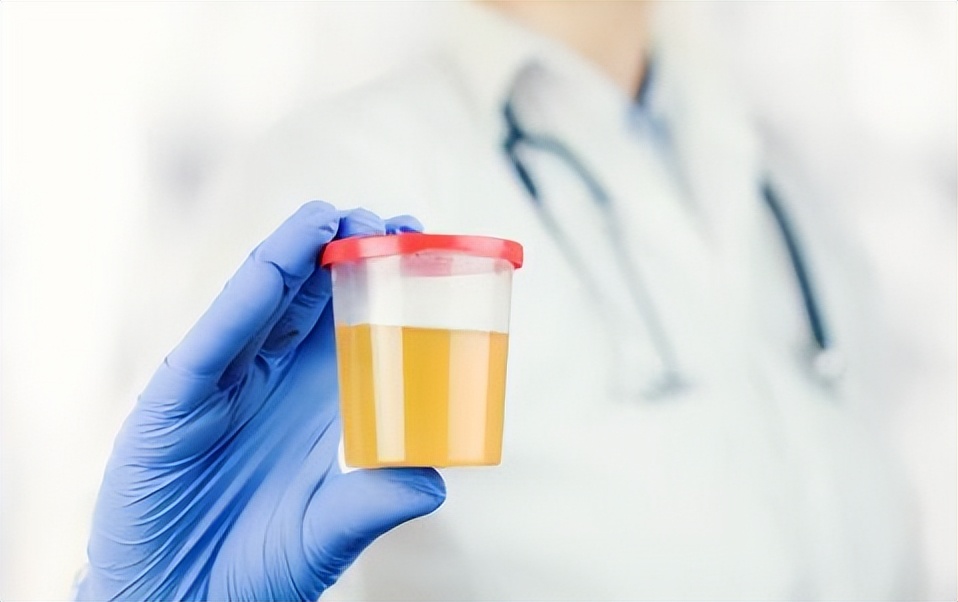 尿潜血试验阳性尿白细胞阳性,尿潜血试验阳性吃什么药治疗